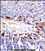 PEAK1 Antibody in Immunohistochemistry (IHC)