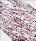Cardiotrophin 1 Antibody in Immunohistochemistry (IHC)
