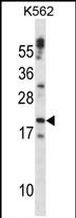 Cardiotrophin 1 Antibody in Western Blot (WB)