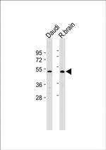 GPR30 Polyclonal Antibody