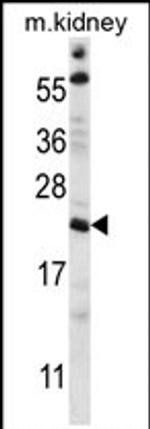 TTC33 Antibody in Western Blot (WB)