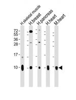 COX7A1 Antibody in Western Blot (WB)