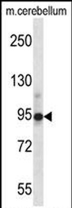 Chordin Antibody in Western Blot (WB)