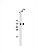RAMP3 Antibody in Western Blot (WB)