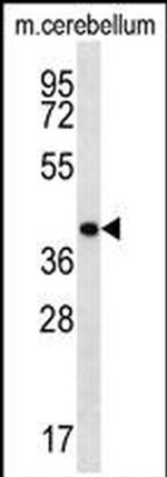 HOXD13 Antibody in Western Blot (WB)