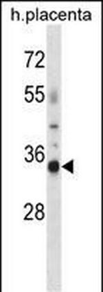 OR4K13 Polyclonal Antibody