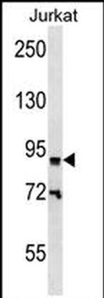 ZNF780B Antibody in Western Blot (WB)