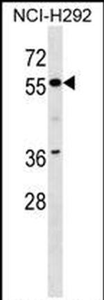 ZNF512 Antibody in Western Blot (WB)
