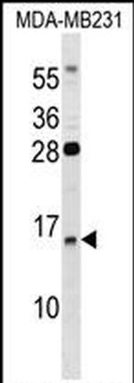GUCA2B Antibody in Western Blot (WB)