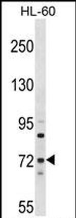 MTMR6 Antibody in Western Blot (WB)