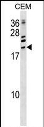 ATF3 Antibody in Western Blot (WB)