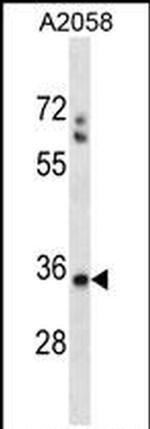 SPEM1 Antibody in Western Blot (WB)