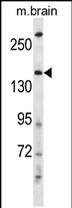 NEDL2 Antibody in Western Blot (WB)