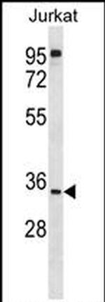 UBXN8 Antibody in Western Blot (WB)