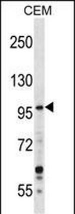 GREB1 Antibody in Western Blot (WB)