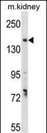 GREB1 Polyclonal Antibody