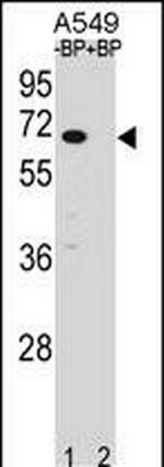 ASB3 Antibody in Western Blot (WB)