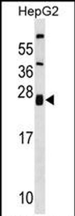 ZNRF1 Antibody in Western Blot (WB)
