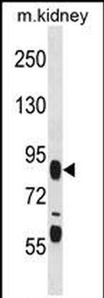 FIGN Antibody in Western Blot (WB)