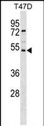 SVOPL Antibody in Western Blot (WB)