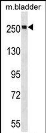 MYH9 Antibody in Western Blot (WB)