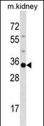 POU5F2 Polyclonal Antibody