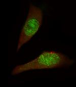 USP27X Polyclonal Antibody