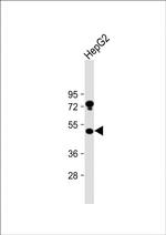 USP27X Antibody in Western Blot (WB)