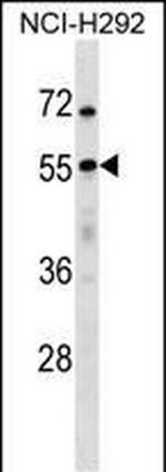 USP27X Antibody in Western Blot (WB)