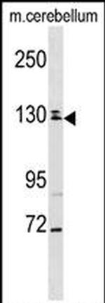 TBC1D8 Antibody in Western Blot (WB)