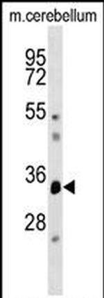 DUSP12 Antibody in Western Blot (WB)