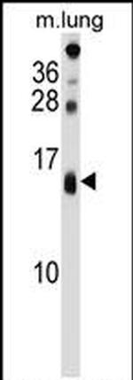 DEXI Antibody in Western Blot (WB)