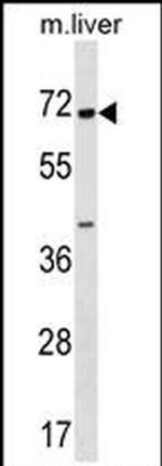 CPNE6 Antibody in Western Blot (WB)