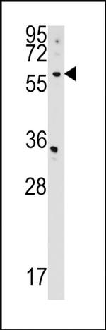 CDS2 Antibody in Western Blot (WB)