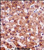 BCL7B Antibody in Immunohistochemistry (IHC)