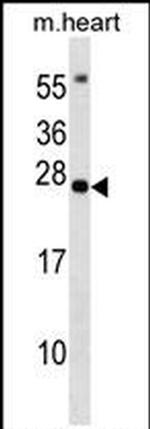 BCL7B Antibody in Western Blot (WB)