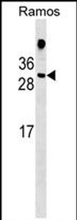 HDGFL1 Antibody in Western Blot (WB)