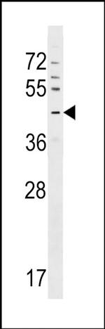 GPR63 Antibody in Western Blot (WB)