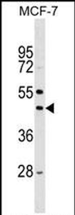 STK32A Antibody in Western Blot (WB)