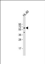 AOAH Antibody in Western Blot (WB)