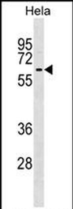 KLHL12 Antibody in Western Blot (WB)