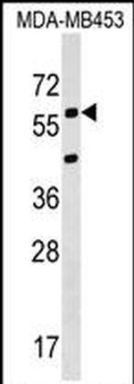 KCNS3 Antibody in Western Blot (WB)