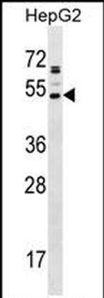AADACL2 Antibody in Western Blot (WB)