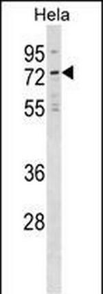 NET1 Antibody in Western Blot (WB)