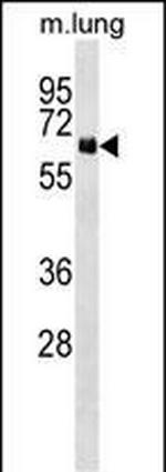 NET1 Polyclonal Antibody