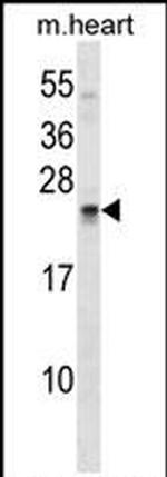 Sostdc1 Antibody in Western Blot (WB)