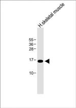 EMP1 Polyclonal Antibody