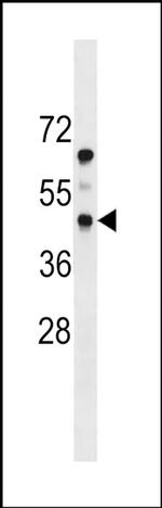 PDGFRL Antibody in Western Blot (WB)