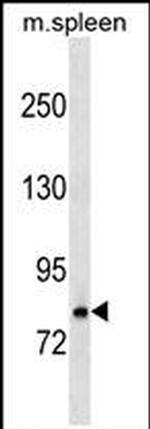 RNaseL Antibody in Western Blot (WB)