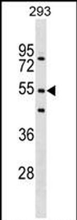 FBXW9 Antibody in Western Blot (WB)